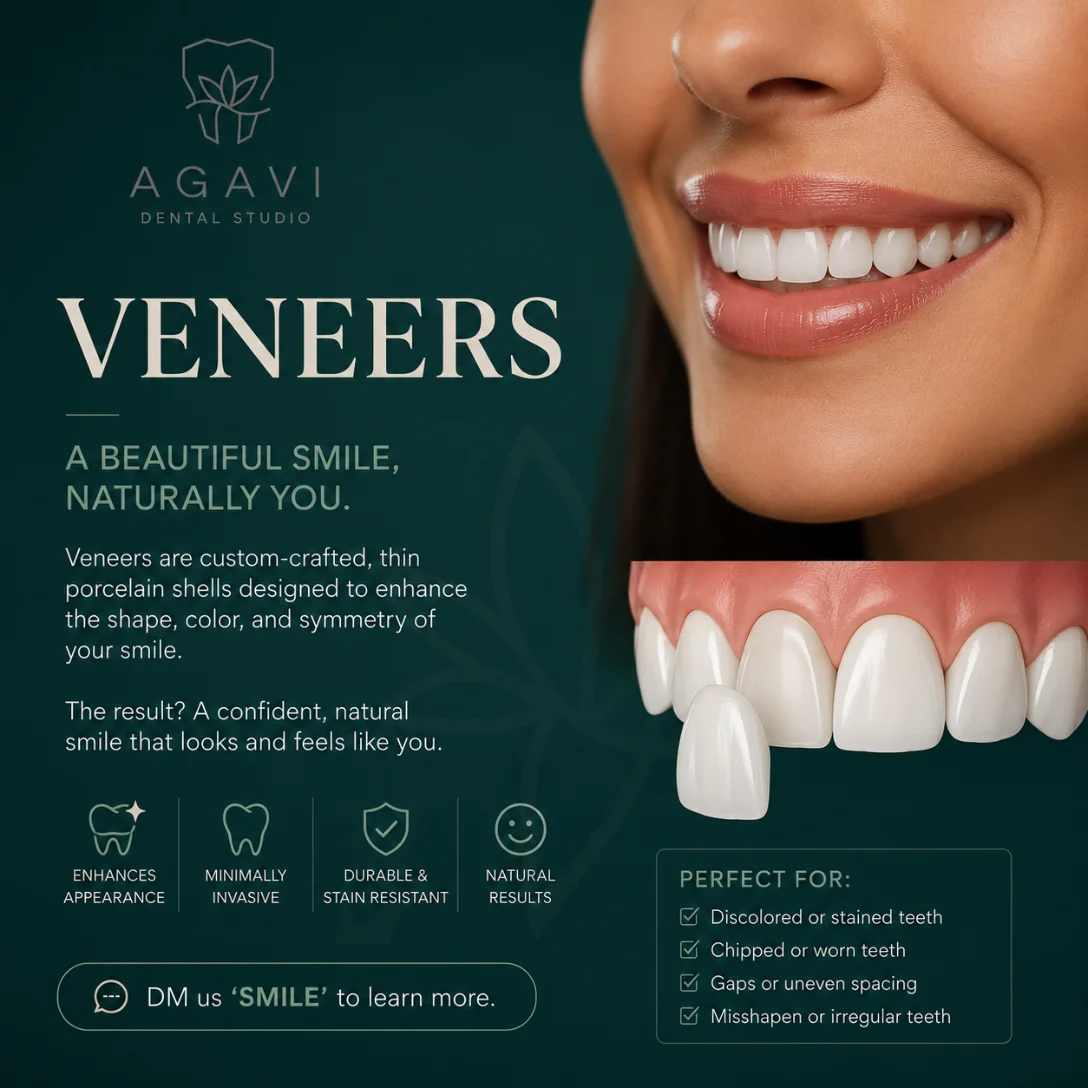 3D-printed veneers crafted in-house